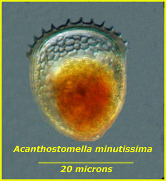 Image de Acanthostomella minutissima Kofoid & Campbell 1929