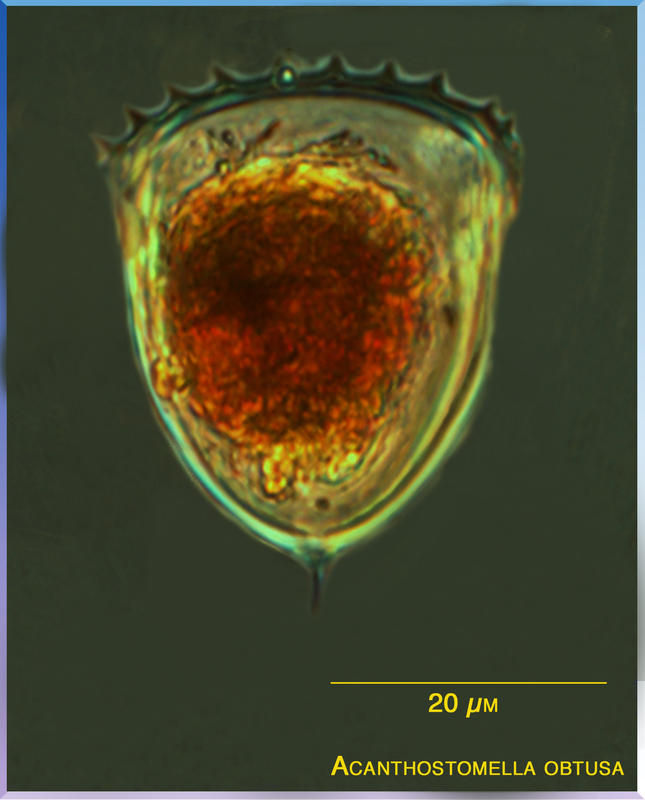 Image of Acanthostomella obtusa Kofoid & Campbell 1929