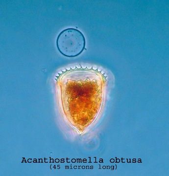 Image of Acanthostomella obtusa Kofoid & Campbell 1929