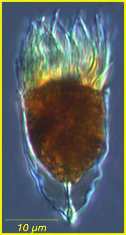 Слика од Acanthostomella conicoides Kofoid & Campbell 1929