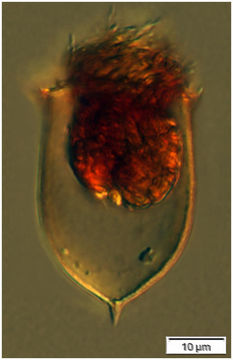 Image de Acanthostomella norvegica (Daday 1887)