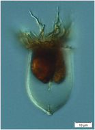 Image de Acanthostomella norvegica (Daday 1887)