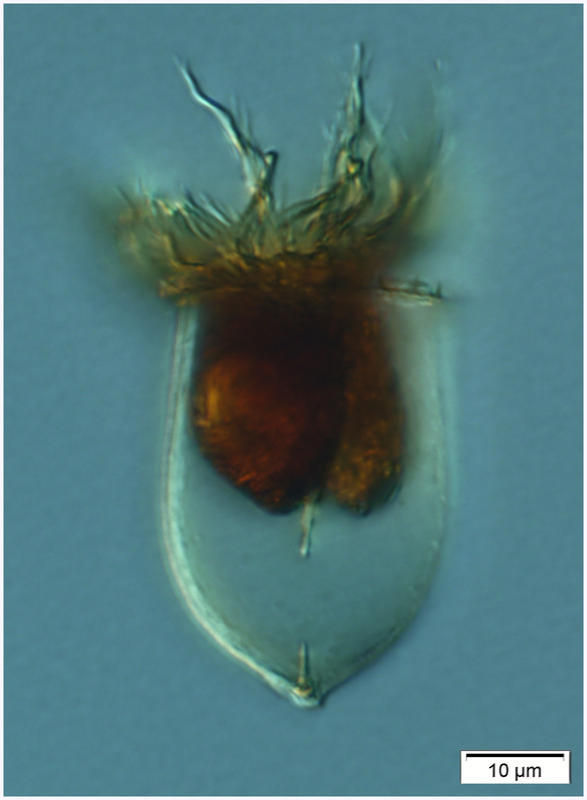 Image of Acanthostomella norvegica (Daday 1887)