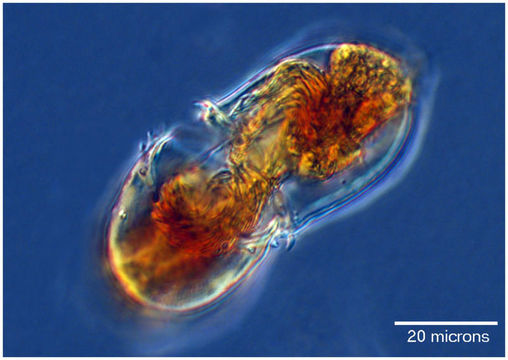 Image of Acanthostomella norvegica (Daday 1887)