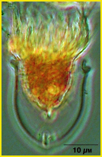 Image de Ascampbelliella armilla (Kofoid & Campbell 1929)