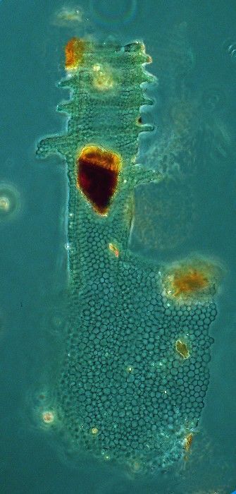 Image de Climacocylis scalaria