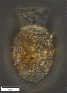 Image of Codonella elongata Kofoid & Campbell 1929