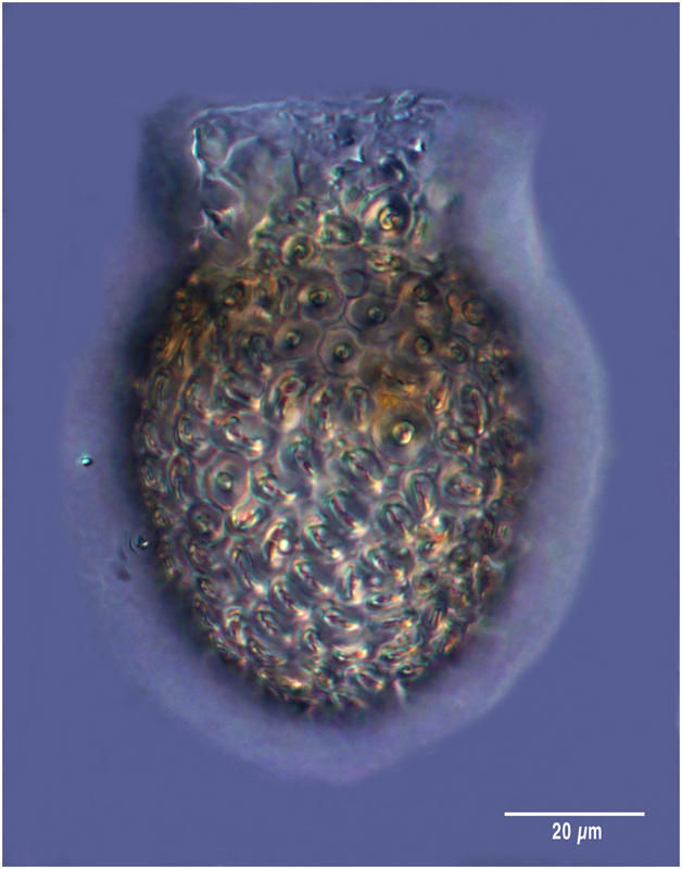 Image of Codonella elongata Kofoid & Campbell 1929