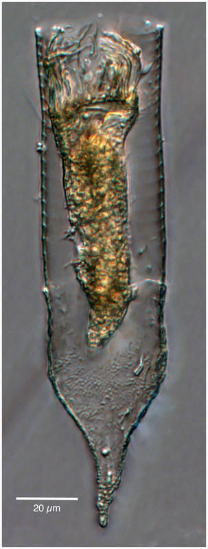 Image of Codonellopsis gaussi