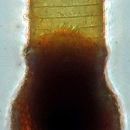 Image of Codonellopsis orthoceras