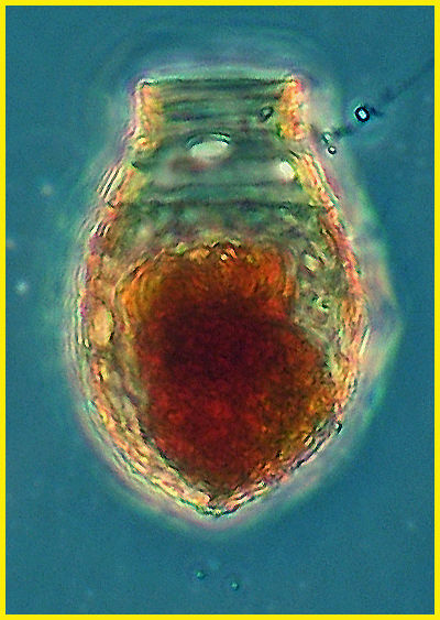 Image of Codonellopsis pusilla (Cleve) Jörgensen 1924