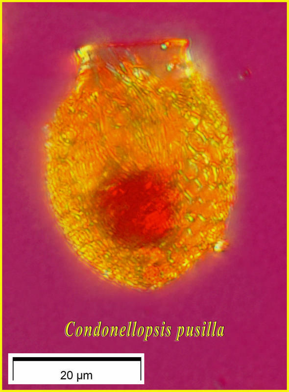 Image of Codonellopsis pusilla (Cleve) Jörgensen 1924