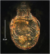 Image of Codonellopsis pusilla (Cleve) Jörgensen 1924