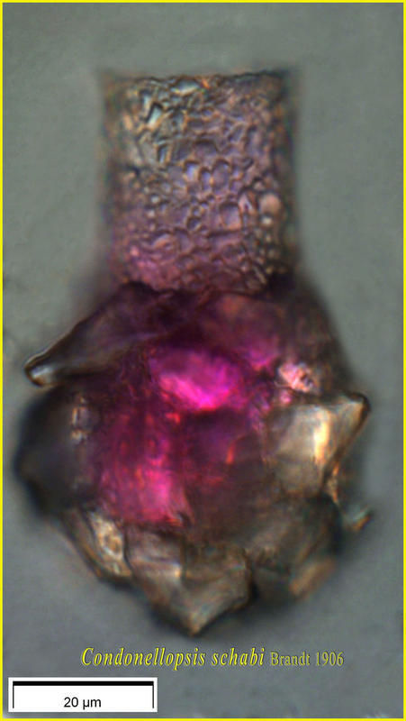 Image of Codonellopsis schabi (Brandt 1906) Kofoid & Campbell 1929