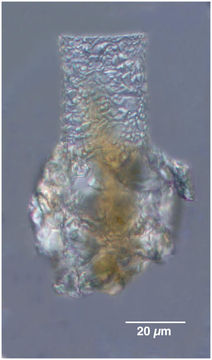 Image of Codonellopsis schabi (Brandt 1906) Kofoid & Campbell 1929