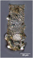 Image of Codonellopsis schabi (Brandt 1906) Kofoid & Campbell 1929