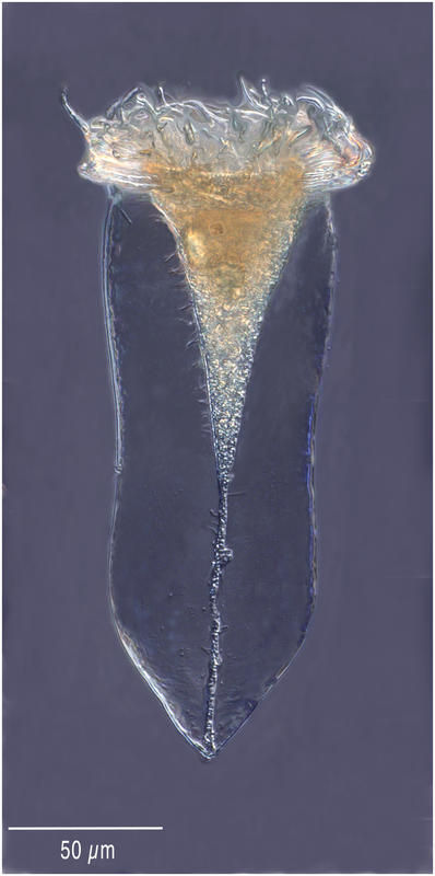 Image of Cymatocylis drygalskii