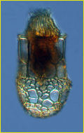 Image of Dictyocysta elegans