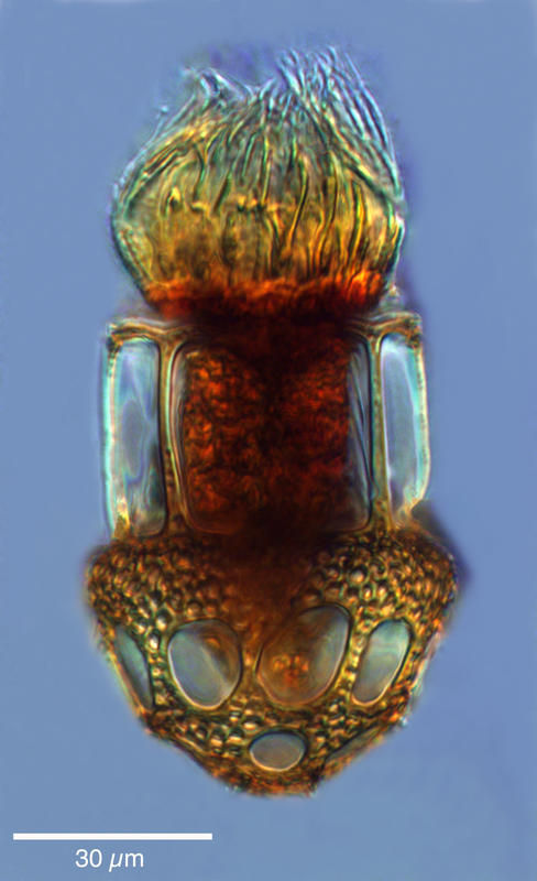 Image of Dictyocysta lepida