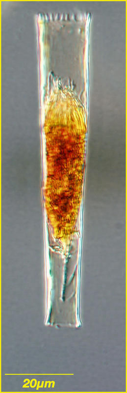 Image of <i>Tintinnus pectinis</i> Kofoid & Campbell 1929