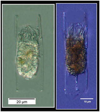 Image of Eutintinnus Kofoid & Campbell 1939