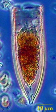 Image of Helicostomella subulata