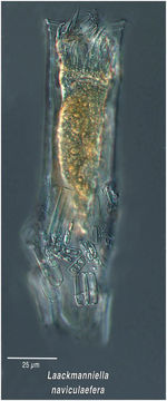 Image of Laackmanniella naviculaefera (Laackmann 1907) Kofoid & Campbell 1929