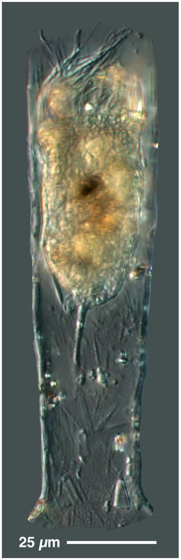 Image of Leprotintinnus pellucidus