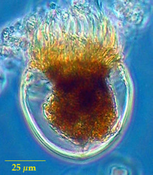 Image of Metacylis mereschkowskii Kofoid & Campbell 1929