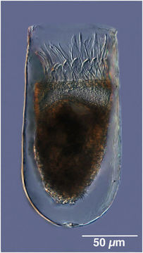 Image of Metacylis vitreoides Kofoid & Campbell 1929