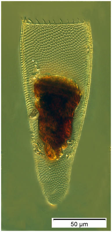 Image of Parafavella hemifusus (Meunier 1910)