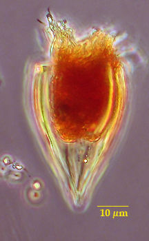 Image of Protorhabdonella simplex