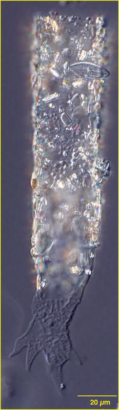 Image of Tintinnopsis cornigera Hada 1964