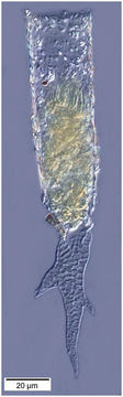 Image of Tintinnopsis cornigera Hada 1964