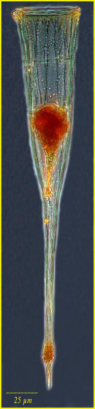 Image of Rhabdonellopsis apophysata (Cleve 1899) Kofoid & Campbell 1929