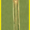 Image of Salpingella attenuata Kofoid & Campbell 1929