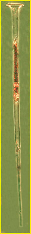 Image of Salpingella attenuata Kofoid & Campbell 1929