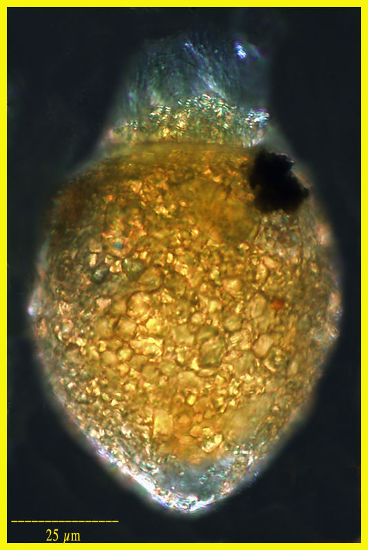 Image of Stenosemella ventricosa