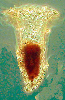 Image of <i>Tintinnopsis butschlii</i>