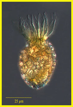 Image of Tintinnopsis parva