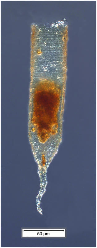 Image of Tintinnopsis radix