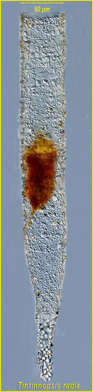 Image of Tintinnopsis radix