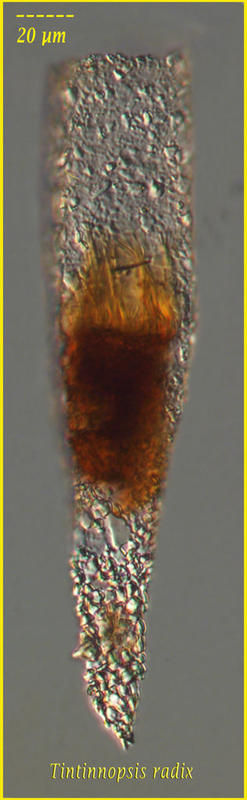 Image of Tintinnopsis radix