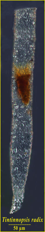 Image of Tintinnopsis radix