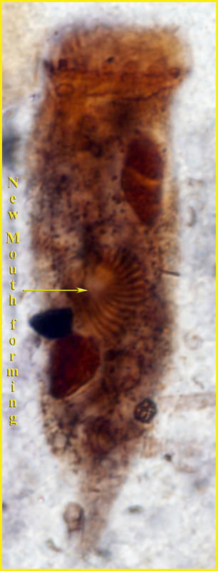 Image of Tintinnopsis radix