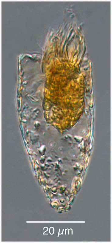 Image of Tintinnopsis rapa