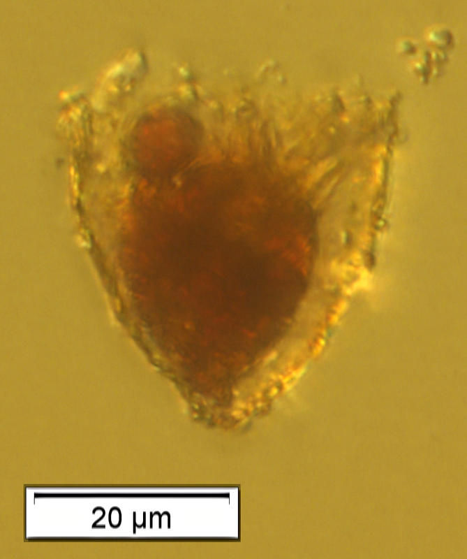 Image of Tintinnopsis subacuta