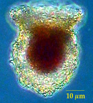 Image of Tintinnopsis urnula