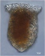 Image of Tintinnopsis urnula