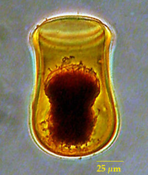 Image of Undellopsis marsupialis (Brandt 1906) Kofoid & Campbell 1929